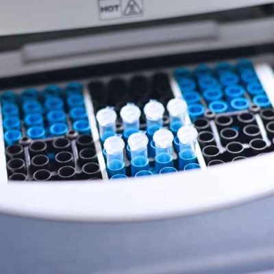 เทคนิคการใช้เครื่องวิทยาศาสตร์ PCR เพื่อเพิ่มจำนวน DNA (2)_2